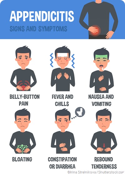 appendicitis symptoms infographic